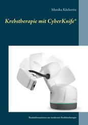 Krebstherapie mit CyberKnife&reg;