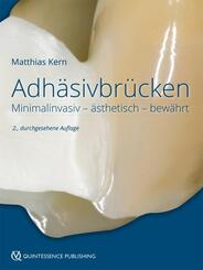 Adh&auml;sivbr&uuml;cken
