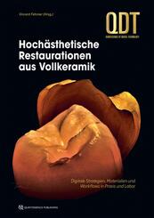Hoch&auml;sthetische Restaurationen aus Vollkeramik