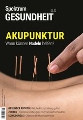 Spektrum Gesundheit- Akupunktur (eBook, PDF)