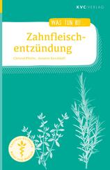 Zahnfleischentz&uuml;ndung